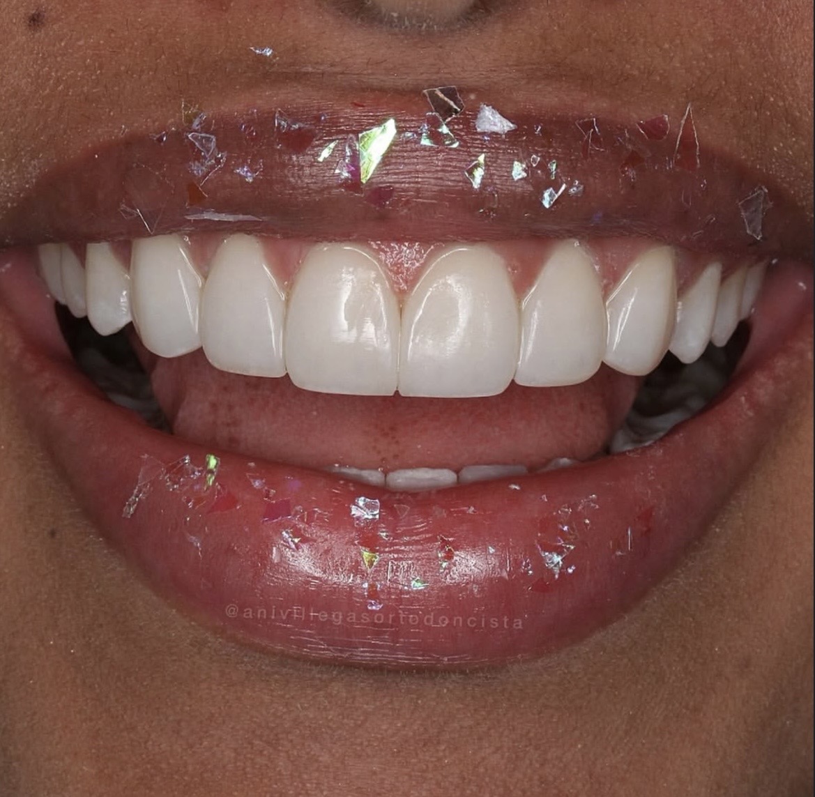 Sonrisa elegante y radiante
